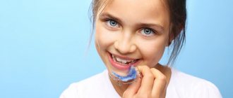 14 most important questions about braces