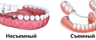 Alternatives to implantation