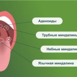 Анатомия горла: расположение миндалин