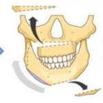 Asymmetry of the lower jaw