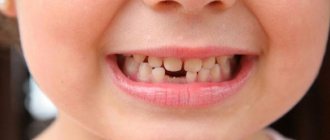 Don&#39;t panic! A child’s baby tooth falls out, but the root remains - what to do? 