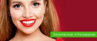 safe teeth whitening