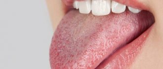 Painful rash in mouth