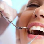 what to do if your gums itch after tooth extraction