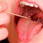 What to do if the root of the tongue hurts when swallowing, why does this happen?