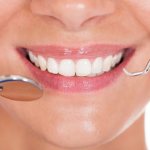 What to do if the enamel on your teeth is worn away