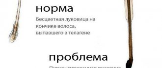 Что делать, если выпадают волосы с белым кончиком