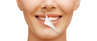 What you need to know about dental restoration