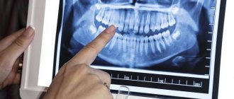 What does a dental orthopantomogram show?