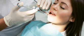 What is carpule anesthesia