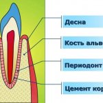 What is gum recession