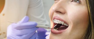 What is tooth separation in dentistry?