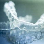 aligners for teeth straightening