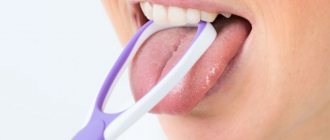 Cleaning your tongue daily will help avoid the problem.