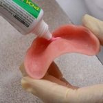 fixation of removable dentures