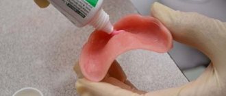 фиксация съемных зубных протезов