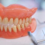 fixation creams for removable dentures