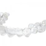 Photos of aligners