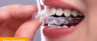 Photo of Invisalign cap