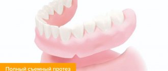 Photo of a complete removable denture