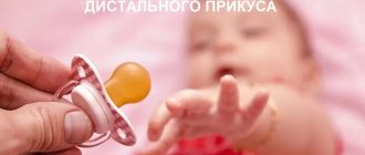 Иногда возникновению патологии способствует недостаток питательных веществ, микроэлементов, а также вредные привычки – сосание игрушек, пустышки