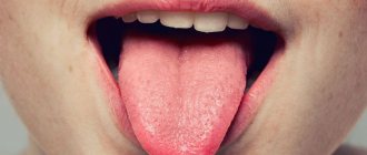 Why does your tongue itch?