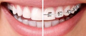 Which doctor should I contact - what is the difference between an orthodontist and an orthopedist in dentistry?