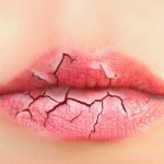 What should healthy lips look like?