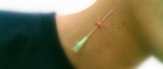 catheter for piercing