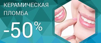 Ceramic filling CEREC with a 50% discount