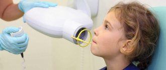 When is a child&#39;s dental x-ray prescribed?