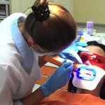 lamp teeth whitening