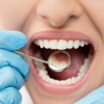 Treatment of dental caries