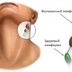 The lymph nodes