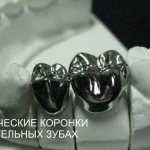 Metal crowns for chewing teeth