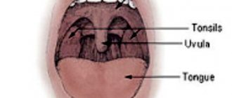 Tonsils in the mouth