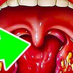 the tongue in the throat swells after drinking alcohol