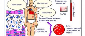 Острая ревматическая лихорадка