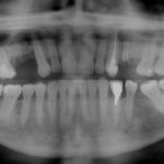 Panoramic radiography