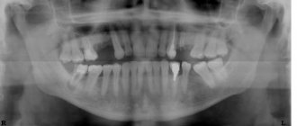 Panoramic radiography