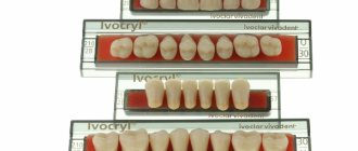 Pros and cons of Ivocryl teeth