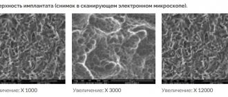 Alpha bio implant surface