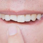 Signs of a fracture - Smile Line Dentistry