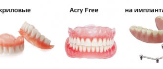 dentures for complete absence of teeth