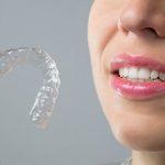 Clear aligners