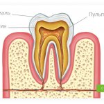 dental pulp