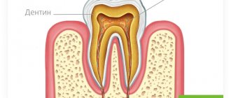 dental pulp