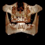 X-ray of the sinuses