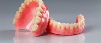 Removable dentures