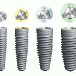 Swiss dental implants